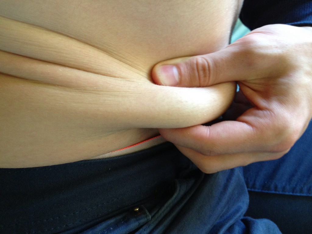 Někoho vzrušuje sexy prádlo, někoho tukové polštářky