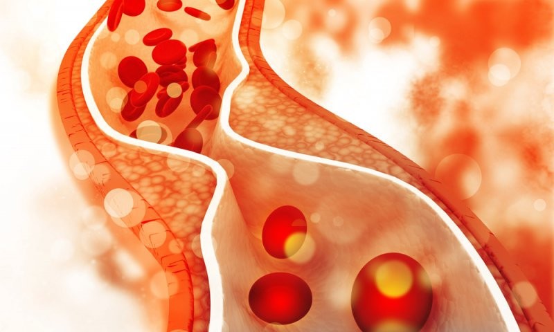 Doporučený maximální příjem cholesterolu u nesportující populace by neměl překračovat 300 mg denně (například 1,5 vejce)