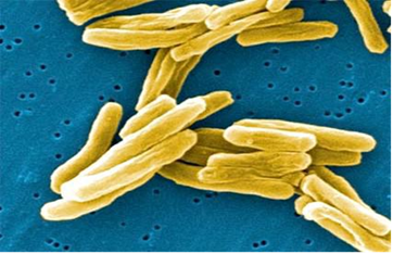 Mycobacterium tuberculosis – původce TBC v elektronovém mikroskopu