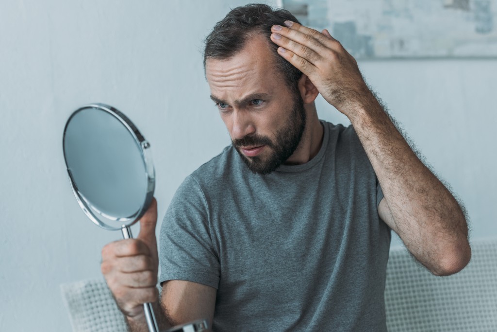 Mezi rizikové faktory vzniku alopecie patří mimo jiné obyčejný stres