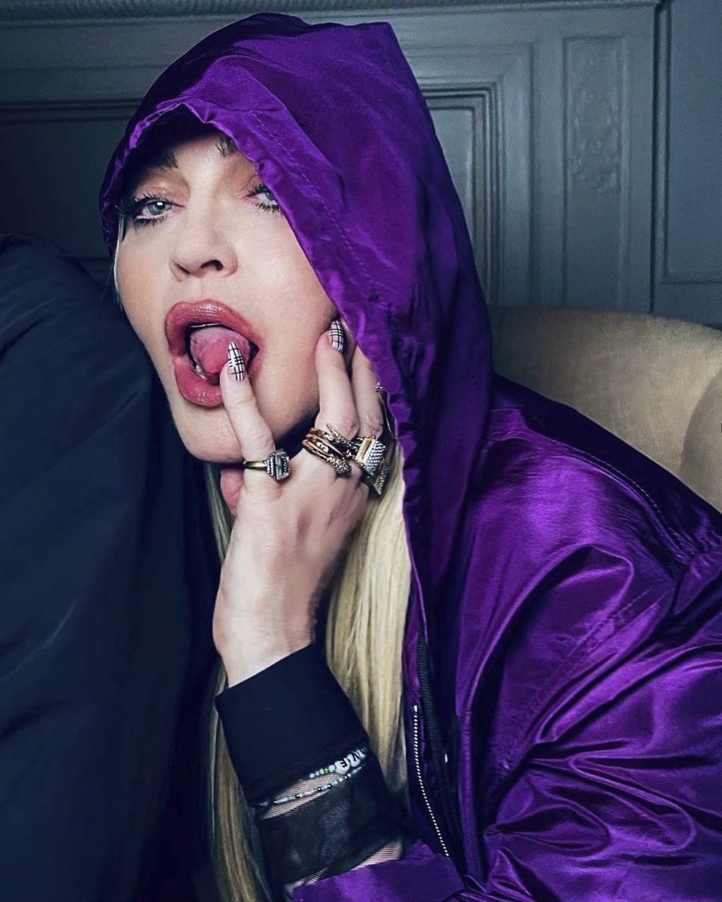 Madonna šokovala fanoušky na instagramu obrovskou modřinou