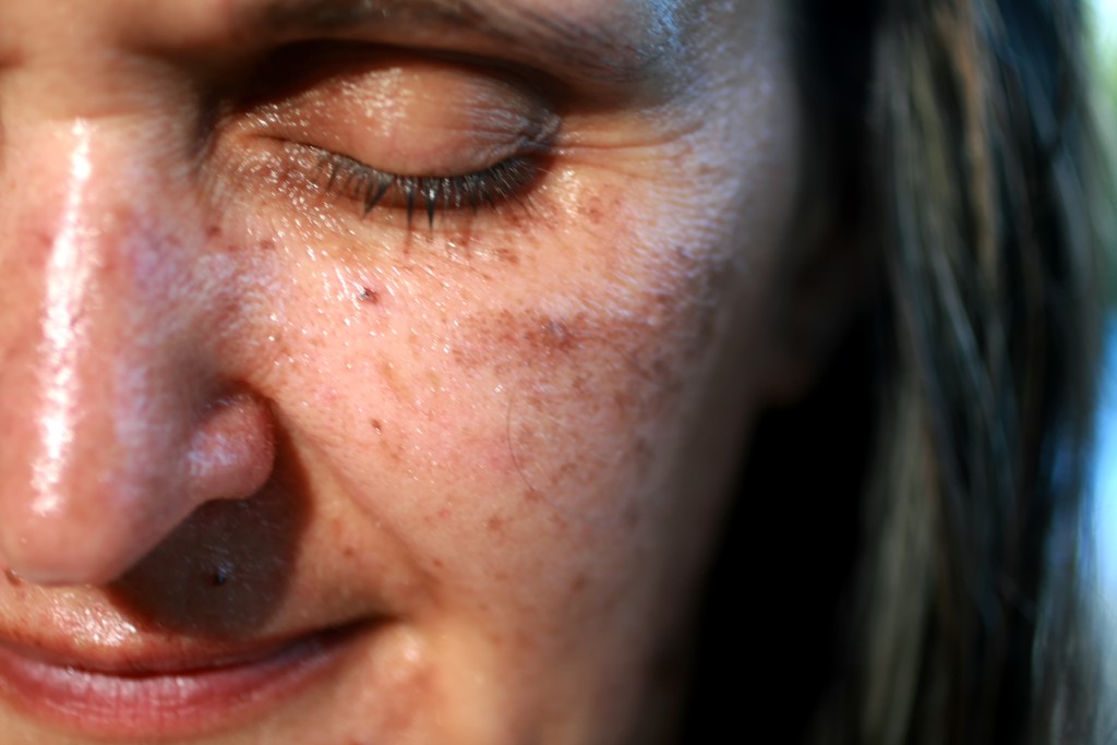 Pigmentových skvrn se můžete zbavit poměrně lehce, pomůže vám s tím mimo jiné i pravidelný peeling