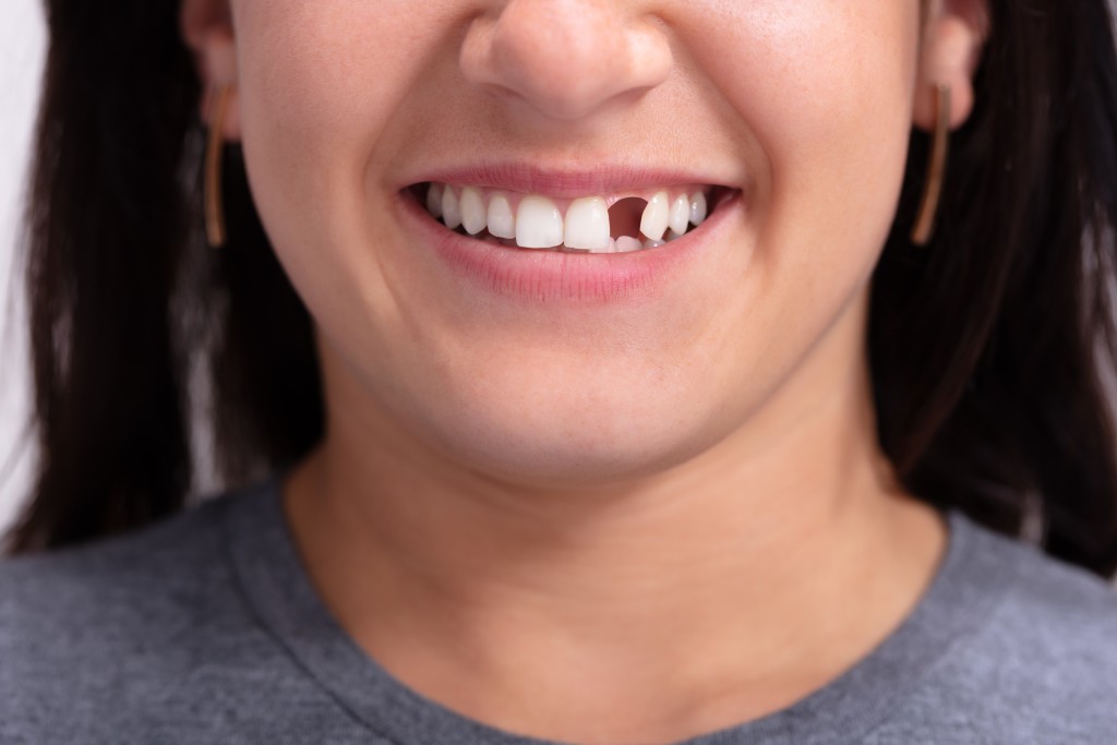 Mezi symptomy cukrovky patří i ztráta zubu