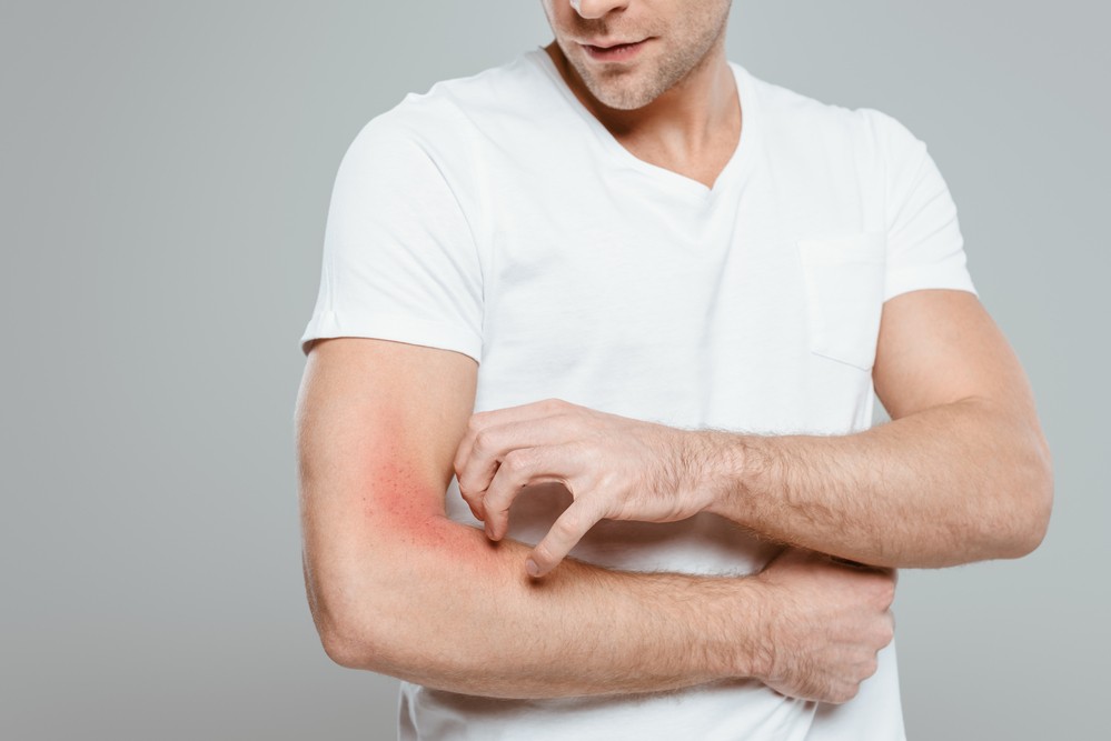 Svědění kůže může být příznakem rakoviny i HIV