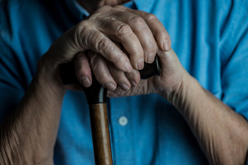 Osteoartrózu poznáte spolehlivě pomocí rozšířených částí prstů