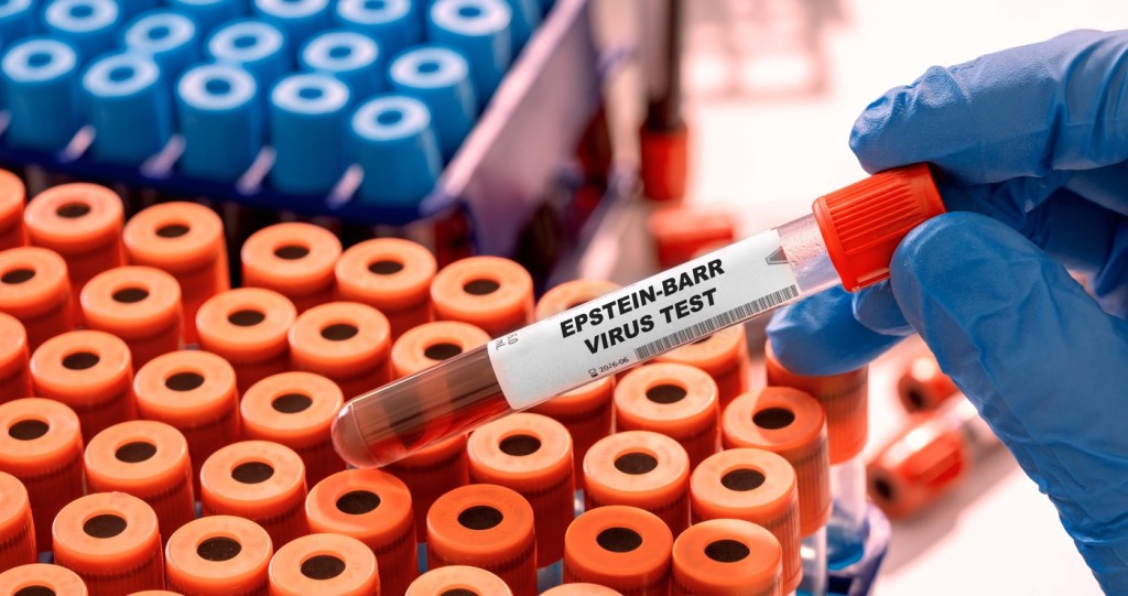 Virus Epsteina–Barrové (lidský herpesvirus 4 nebo EB virus), je virus z čeledi herpes virů