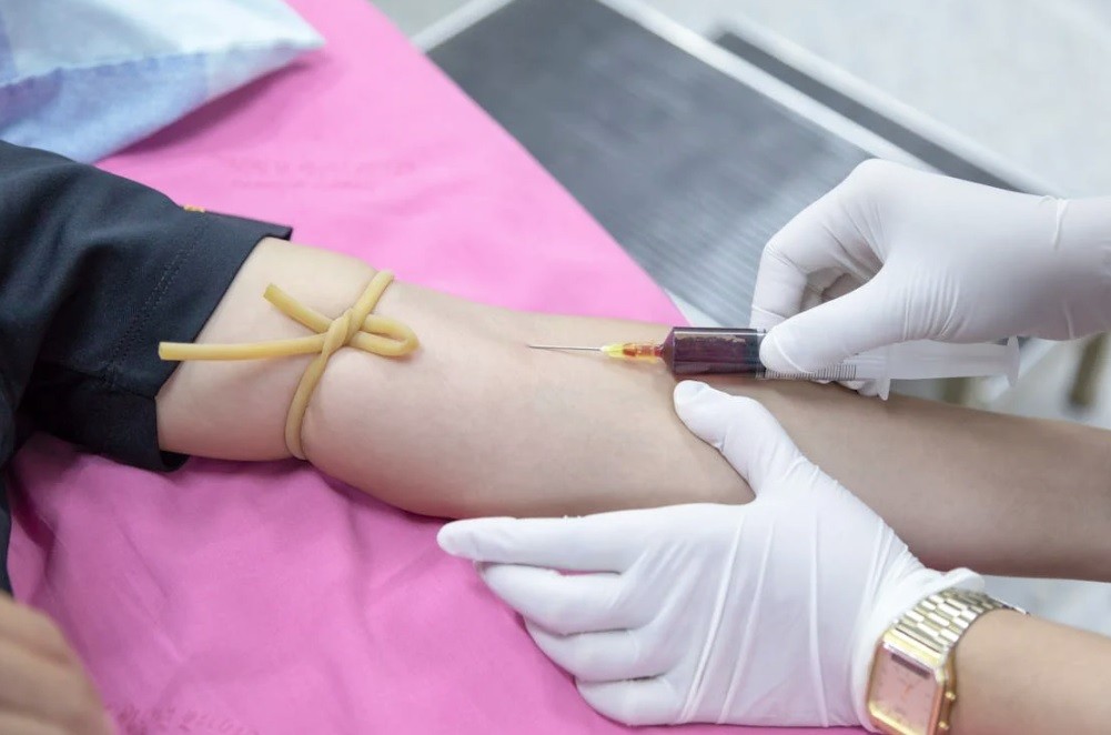 Darování krevní plasmy vyžaduje odhodlání a odvahu. Důležitou součástí krevní plasmy je albumin