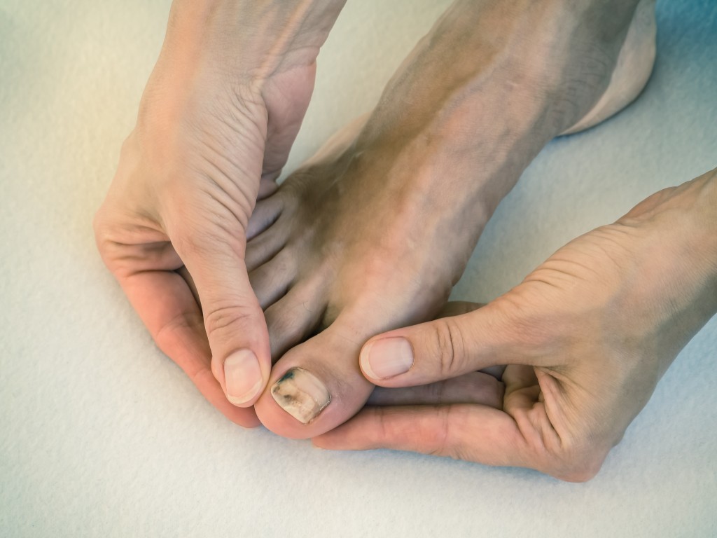 Mezi prevenci plísně na nehtech patří i jejich pravidelné zastřihávání