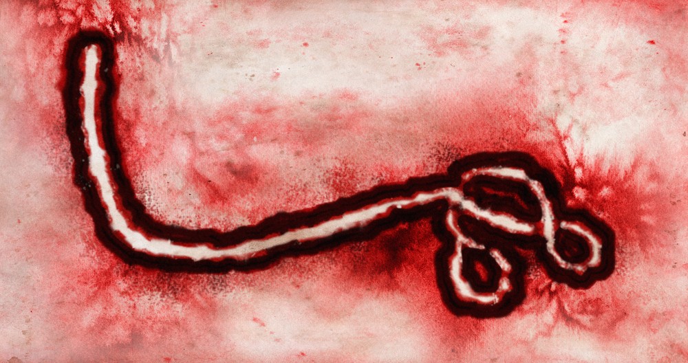 Ebola představuje jednu z nejnebezpečnějších nákaz, s jakou se kdy lidstvo setkalo. Původcem onemocnění je filovirus ebola