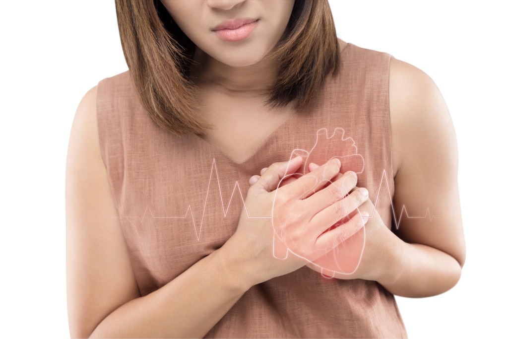Infarkt myokardu je náhlé přerušení krevního zásobování části srdce