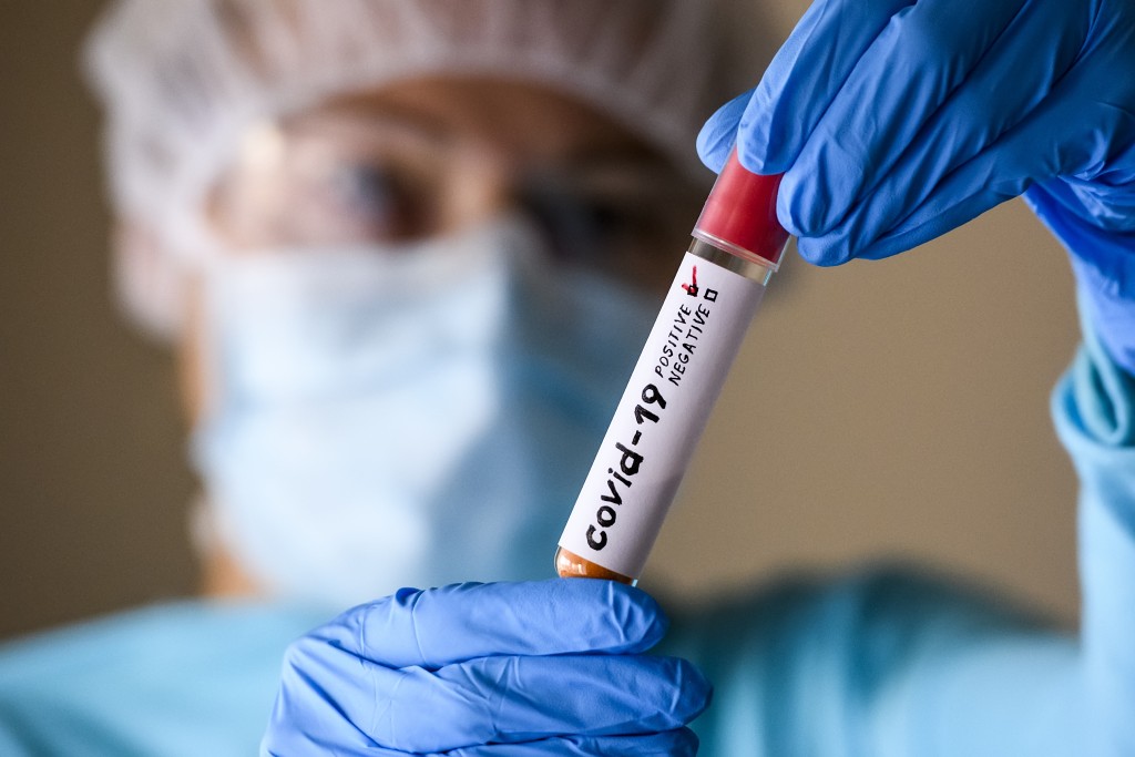 Podle viroložky Hany Zelené není důvod k panice